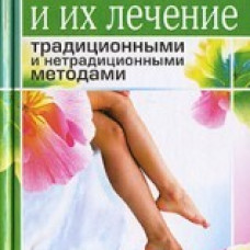 Болезни ног и их лечение традиционными и нетрадиционными методами